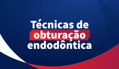 Obturação endodôntica: conheça 4 técnicas
