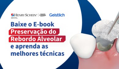 [Baixe agora] E-book Preservação do Rebordo Alveolar