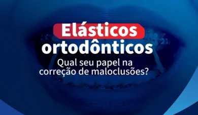 Elásticos Ortodônticos: Guia Completo para um Tratamento Moderno e Eficaz
