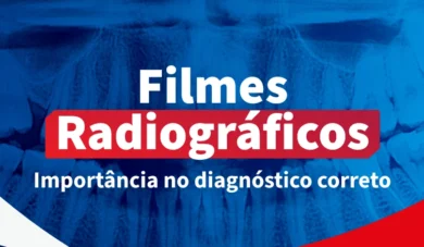 Escolhendo filmes radiográficos: tudo que você precisa saber