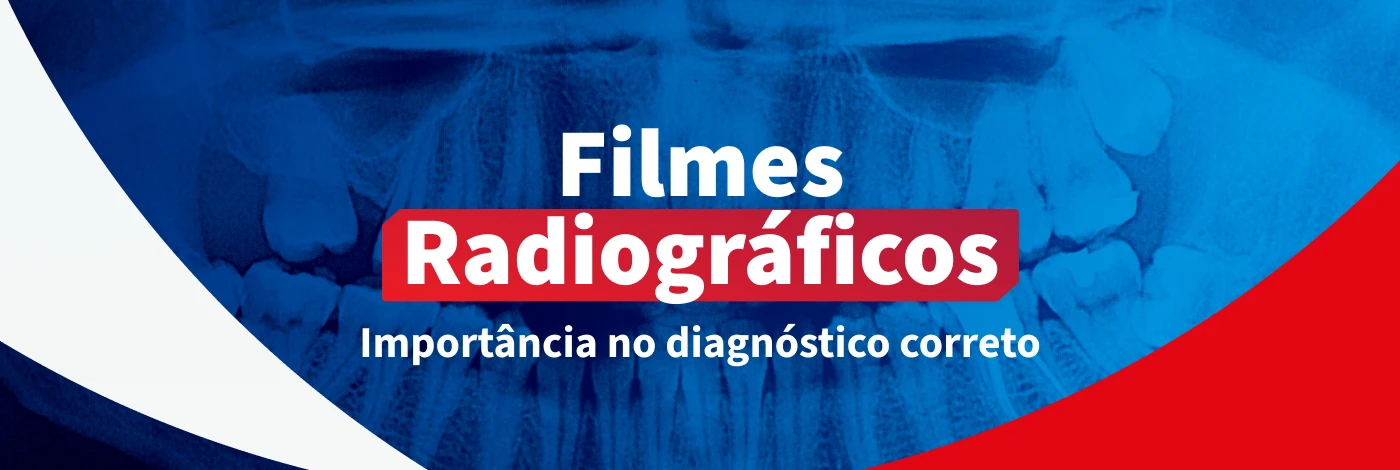 Escolhendo filmes radiográficos: tudo que você precisa saber - Blog ...