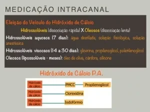 Imagem explicativa sobre a medicação intracanal hidróxido de Cálcio, destacando suas diferentes formas, uso em odontologia.