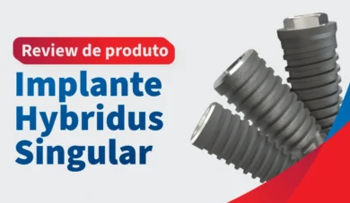 Review do Implante Hybridus da Singular: Indicações, Vantagens e Desvantagens