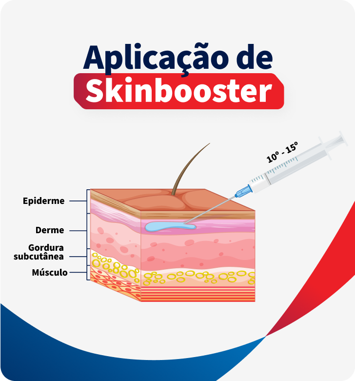 como é realizada a aplicação do skinbooster no paciente de harmonização orofacial