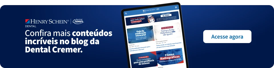 Imagem de um site da Dental Cremer exibindo conteúdos sobre saúde bucal e odontologia, promovendo seu blog com dicas, vídeos, radiografias e mais.
