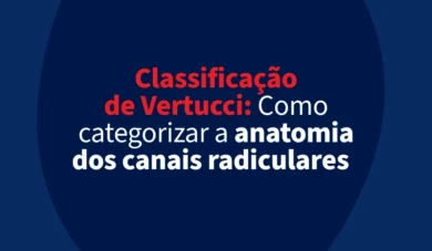 Classificação Vertucci seu Guia Definitivo!