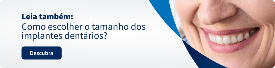 Imagem mostrando uma pessoa sorridente com dentes brancos, promovendo dicas sobre escolha do tamanho dos implantes dentários.