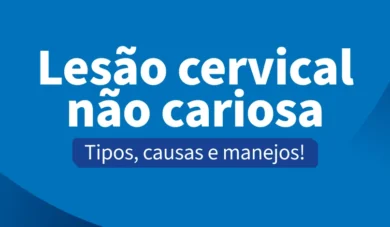 Lesões cervicais não cariosas: guia completo de etiologia, diagnóstico e tratamento