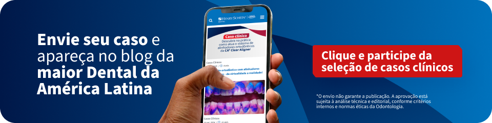 Envie o seu caso clínico | Blog Dental Cremer | Henry Schein