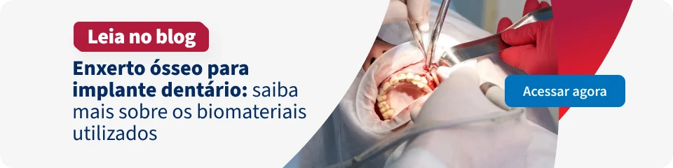 Imagem de um procedimento de implante dentário sendo realizado, destacando o uso de biomateriais e técnicas odontológicas avançadas.