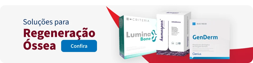 Imagem de produtos para regeneração óssea, incluindo Lumina Bone, GenDerm e Membrana Criteriada para tratamentos de saúde óssea.