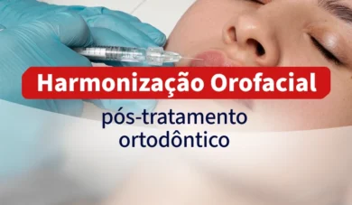 Equilíbrio funcional e estético: a Harmonização Facial após o tratamento ortodôntico