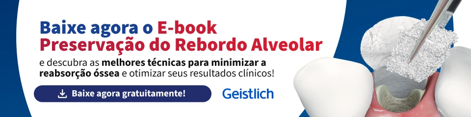Banner em português para download do e-book “Preservação do Rebordo Alveolar”, com texto sobre melhores técnicas para reduzir a reabsorção óssea e botão “Baixe agora gratuitamente”, destacando a marca Geistlich e uma ilustração odontológica ao lado.