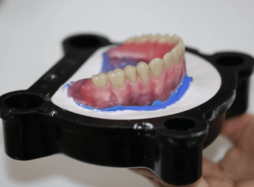 Molde com dentes prot&eacute;ticos em resina, simulando uma pr&oacute;tese dent&aacute;ria, apoiado em uma mufla fixa&ccedil;&atilde;o durante procedimento odontol&oacute;gico.