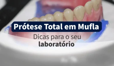 Inclusão de Prótese Total em Mufla: O Passo a Passo para um Trabalho Impecável